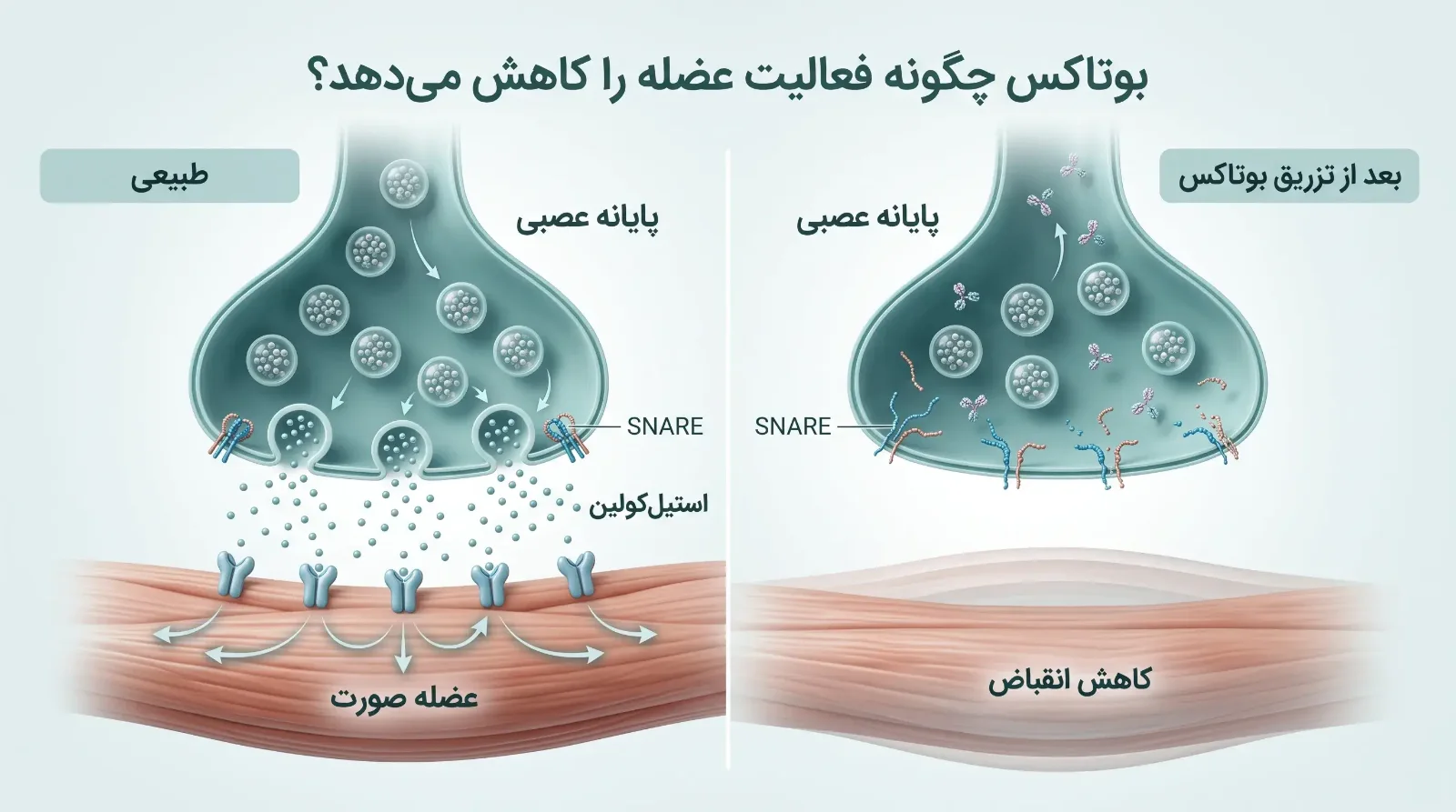 مراقبتهای بعد از بوتاکس