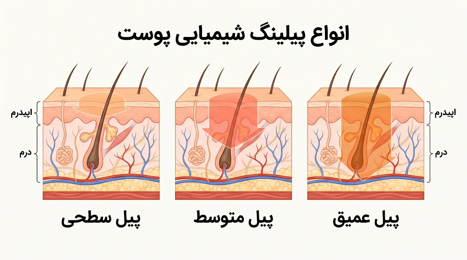 پیلینگ شیمیایی صورت چیست؟