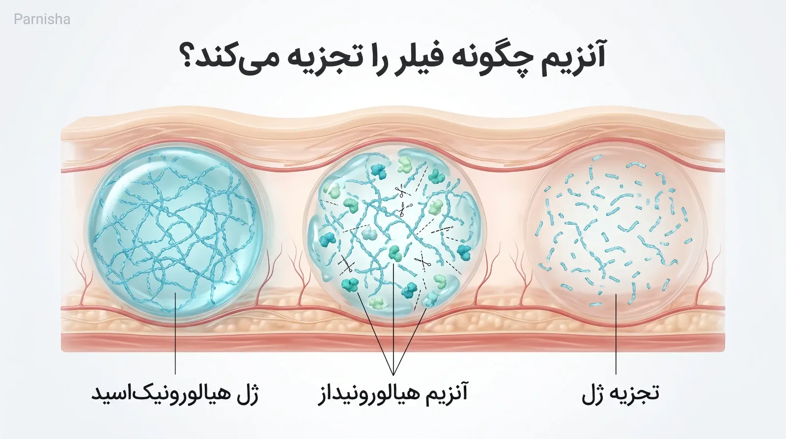 حل کردن فیلر با آنزیم