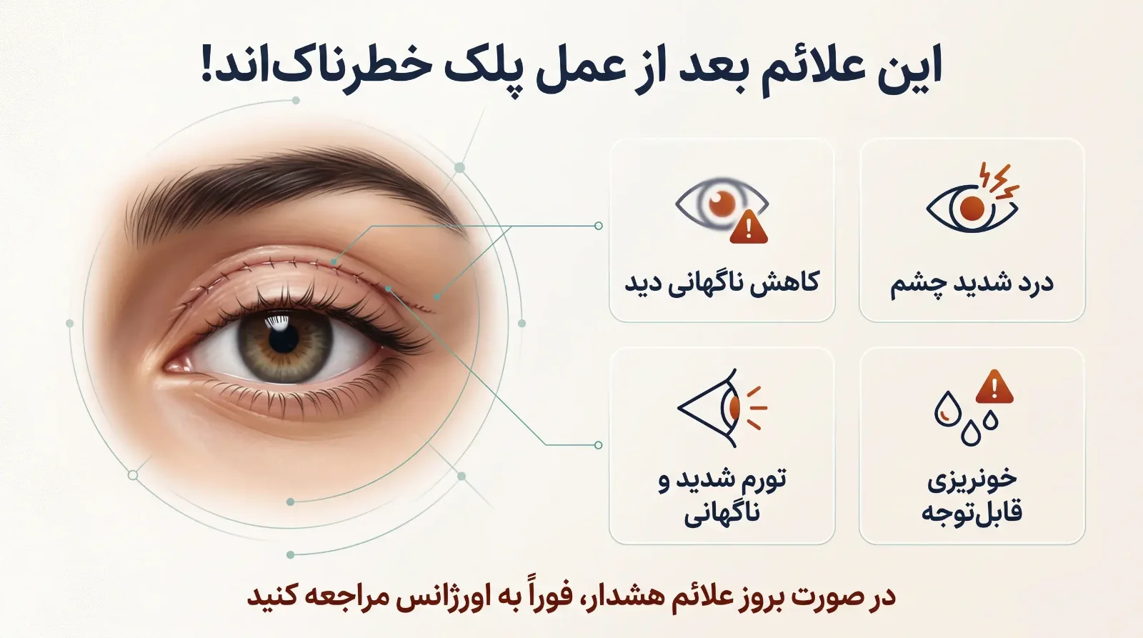 بعد از بلفاروپلاستی